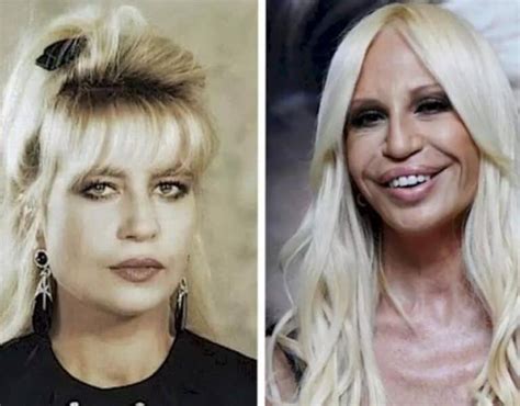 versace antonella protesi|donatella versace real face.